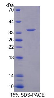 Figure 1. SDS-PAGE