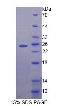 Figure 1. SDS-PAGE