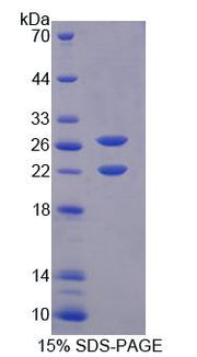 Figure 1. SDS-PAGE