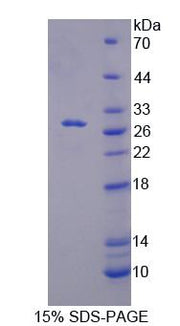 Figure 1. SDS-PAGE