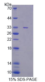 Figure 1. SDS-PAGE