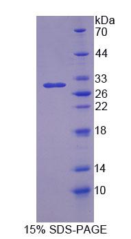Figure 1. SDS-PAGE