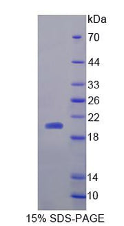 Figure 1. SDS-PAGE