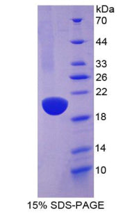 Figure 1. SDS-PAGE