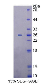 Figure 1. SDS-PAGE