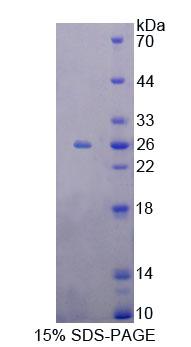 Figure 1. SDS-PAGE