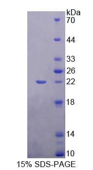 Figure 1. SDS-PAGE