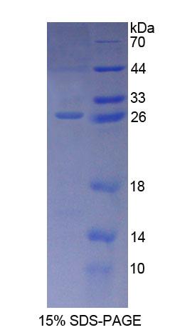 Figure 1. SDS-PAGE