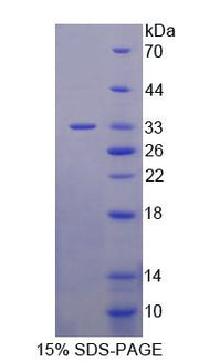 Figure 1. SDS-PAGE