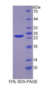Figure 1. SDS-PAGE