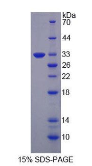 Figure 1. SDS-PAGE