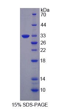 Figure 1. SDS-PAGE