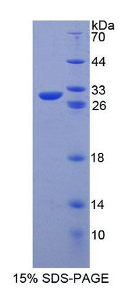 Figure 1. SDS-PAGE