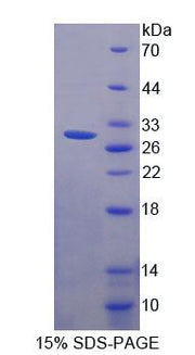 Figure 1. SDS-PAGE