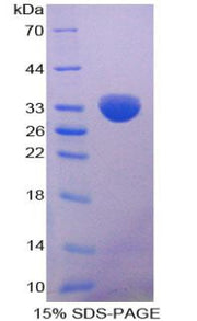 Figure 1. SDS-PAGE