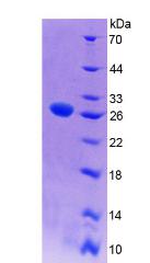 Figure 2. SDS-PAGE