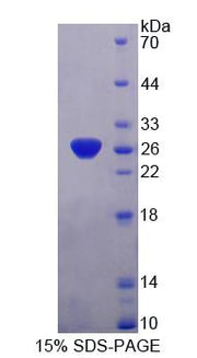 Figure 1. SDS-PAGE