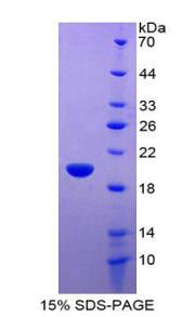 Figure 1. SDS-PAGE