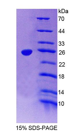 Figure 1. SDS-PAGE