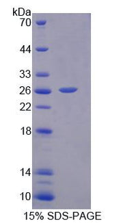 Figure 1. SDS-PAGE
