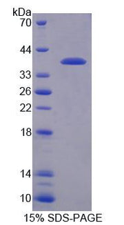 Figure 1. SDS-PAGE