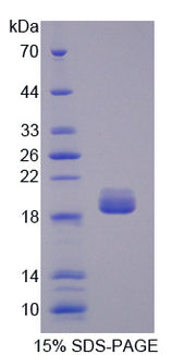 Figure 1. SDS-PAGE
