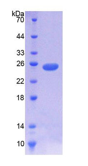 Figure 1. SDS-PAGE
