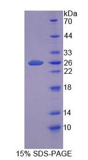 Figure 1. SDS-PAGE