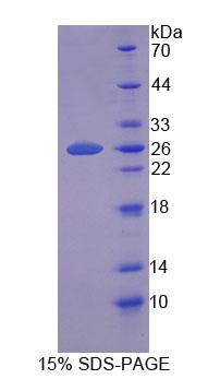 Figure 1. SDS-PAGE