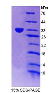 Figure 1. SDS-PAGE