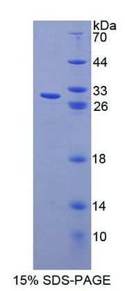Figure 1. SDS-PAGE