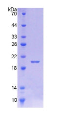 Figure 2. SDS-PAGE