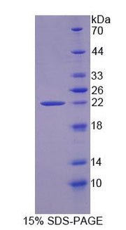 Figure 1. SDS-PAGE
