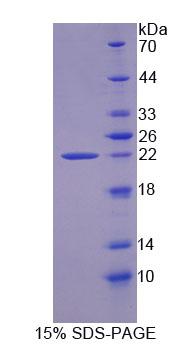 Figure 1. SDS-PAGE