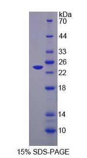 Figure 1. SDS-PAGE