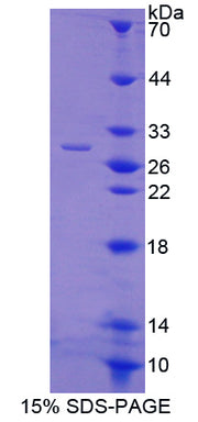Figure 1. SDS-PAGE