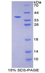 Figure 1. SDS-PAGE
