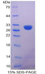 Figure 1. SDS-PAGE