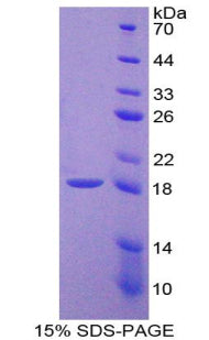 Figure 1. SDS-PAGE