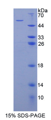 Figure 1. SDS-PAGE