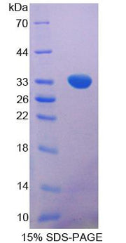 Figure 1. SDS-PAGE