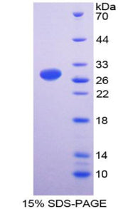 Figure 1. SDS-PAGE