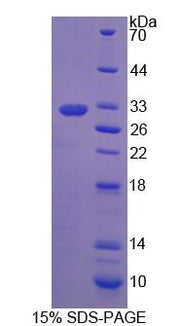 Figure 1. SDS-PAGE