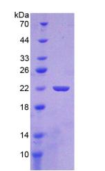 Figure 3. SDS-PAGE