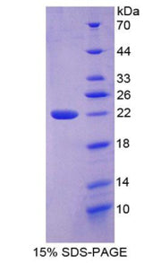Figure 1. SDS-PAGE