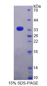 Figure 1. SDS-PAGE
