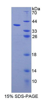 Figure 1. SDS-PAGE