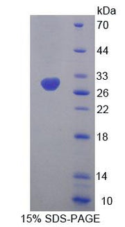 Figure 1. SDS-PAGE