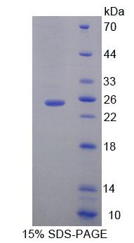 Figure 1. SDS-PAGE