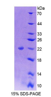 Figure 1. SDS-PAGE